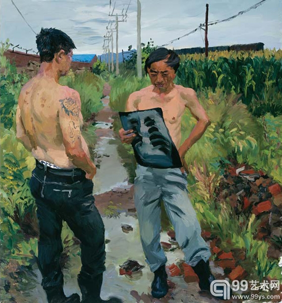 肋骨弯了