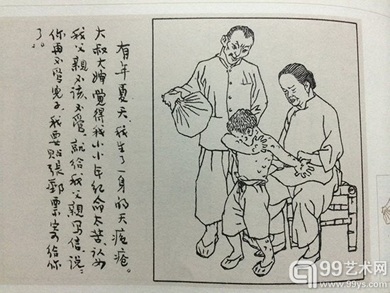 有年夏天，我生了一身的天疱疮。大叔大婶觉得我小小年纪命太苦，认为我父亲不该不管，就给我父亲写信说，“你再不管儿子我要贴张邮票寄给你了。”