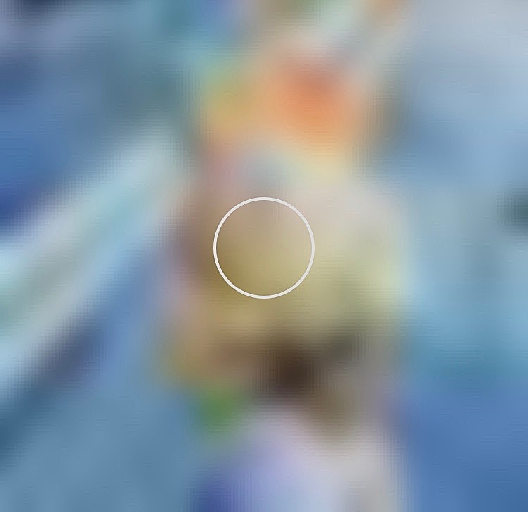 \