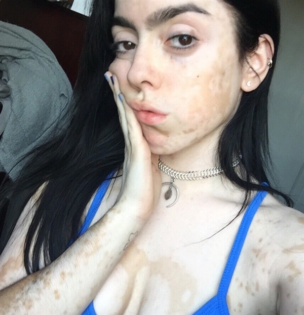 \