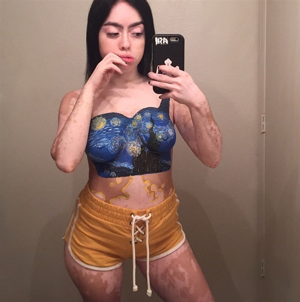 \
