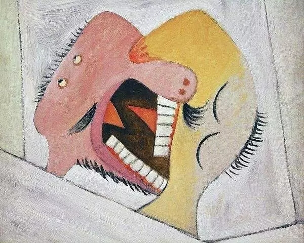 \