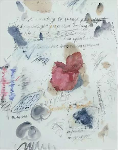 切片18 / Pathological Section 18｜35x28cm｜纸本综合材料 / Mix media on paper｜2016