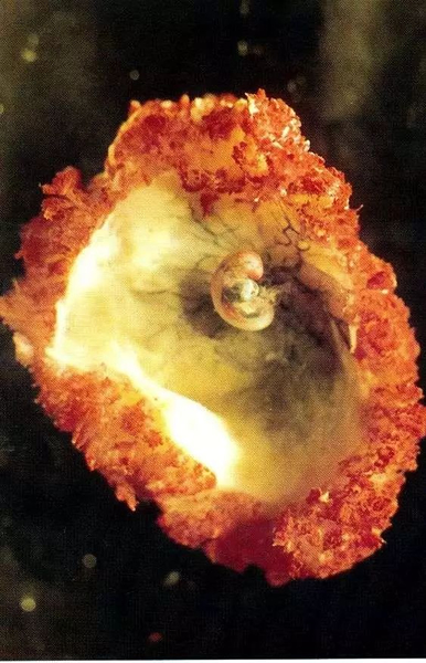 人类胚胎 Human embryo