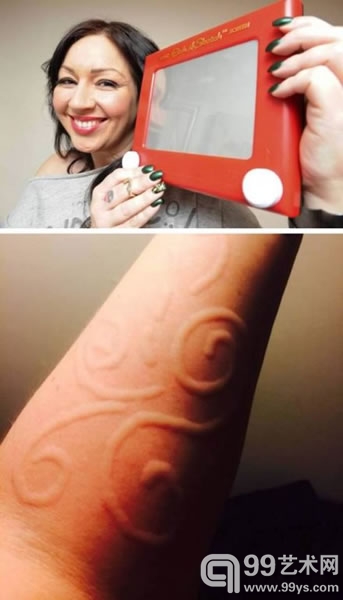 \